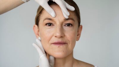 Na imagem, rejuvenescimento facial